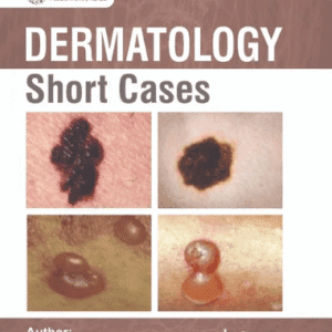 DERMATOLOGY Short Cases