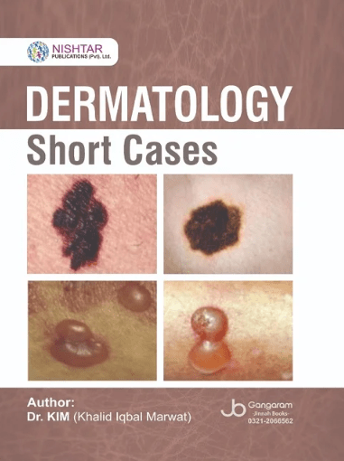 DERMATOLOGY Short Cases