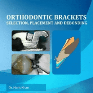 Orthodontic Brackets Selection Placement and Debonding