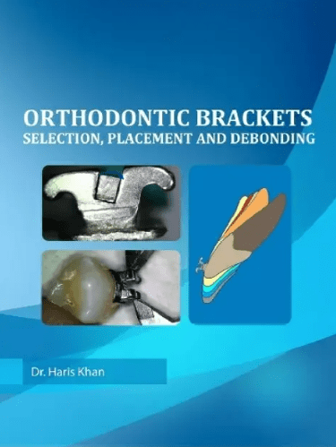 Orthodontic Brackets Selection Placement and Debonding