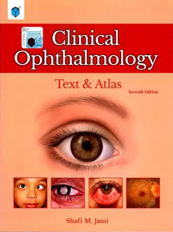 Clinical Ophthalmology Text & Atlas By Jatoi
